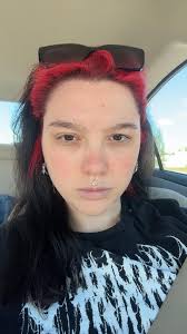 Recommendations for facial fillers and skin care?