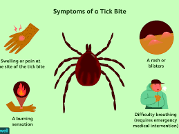 Don't twist or jerk the tick; What You Need To Know About Getting A Tick Bite