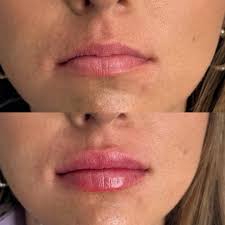 Camille Arledge AGACNP-BC, MSN (@thekisscamssa) • Instagram photos and  videos