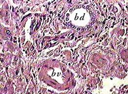 Hepatocytes display an eosinophilic cytoplasm, reflecting numerous. Liver