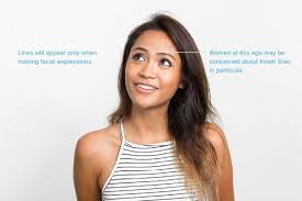 How many botox units are needed for laugh lines? What Is The Best Age To Have Botox Treatment