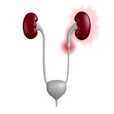 Ureteral Stent Placement What Is A Ureteral Stent Urology Austin