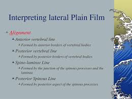 .body line) spinolaminar line cervical lordosis (cervical lordodic angle) cervical gravity line ruth of vertebral body to spinolaminar junction posterior vertebral body line lines/measurements of. Ppt C Spine Plain Films Powerpoint Presentation Free Download Id 270401