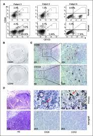 Polyps (growths) can change after a series of mutations (abnormalities) arise in their cellular dna. Cd44 Is Of Functional Importance For Colorectal Cancer Stem Cells Clinical Cancer Research