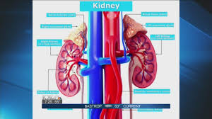 Doctor Discusses Relationship Between Heart And Kidneys Youtube