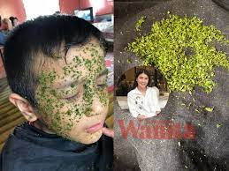 Resdung boleh disebabkan virus, bakteria atau kulat (fungus). Sapu Air Perahan Limau Tepek Hirisan Daun Pandan Di Muka Petua Tradisional Untuk Sakit Resdung Kronik Mingguan Wanita