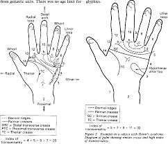 Thenar means ball of the thumb. the thenar. Figure 2 From Alzheimer Type A Case Control Study Dermatoglyphic Patterns In Dementia Of The Semantic Scholar