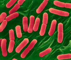 Meaning of escherichia coli 2. E Coli O157 H7 Escherichia Coli Expert Witness And Epidemiology Services