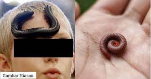 Doctor in the house pun xbce lg. Jangan Panik Bila Ulat Gonggok Serang Tapi Bahaya Untuk Kanak Kanak Jika Terkena Gigitan