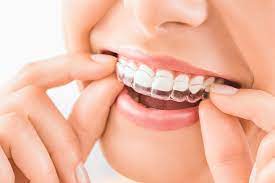 Aug 11, 2009 · costs for braces vary depending on the type of treatment and the severity of the problem, but an average range is $5,000 to $7,500. Does Dental Insurance Cover Orthodontic Care Rmhp Blog