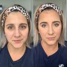 Wockeisha Got A Face Lift 😮‍💨⭐️