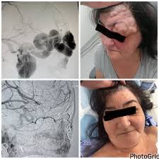 Fausto Ferraz, MD, PhD