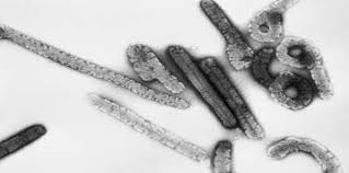 マールブルグウイルスを原因 ► transmission electron microscopic images of marburgviruses‎ (5 f). Rare Antibody Targets Ebola And Marburg Virus Healthmanagement Org