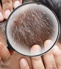Apply the paste to your child's hair using a pair of gloves. à¤¸à¤« à¤¦ à¤¬ à¤² à¤¸ à¤› à¤Ÿà¤• à¤° à¤ª à¤¨ à¤• à¤˜à¤° à¤² à¤‡à¤² à¤œ White Hair Safed Baal Treatment At Home In Hindi