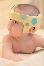 Assimetria craniana nos bebês: entenda as causas e conheça as opções de  tratamentos - Revista Crescer | Saúde