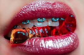 6 Surprising Facts About Braces That You May Not Know - Anew Dental &  Orthodontics