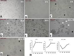 Camel case (sometimes stylized as camelcase or camelcase; Thermotolerance And Plasticity Of Camel Somatic Cells Exposed To Acute And Chronic Heat Stress Sciencedirect