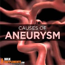 Cerebral aneurysm (aneurysm in the brain). Aneurysm Symptoms Causes Treatment Bulksupplements Com