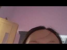 Makin hari makin gede tuh jerawat. Udah Gede Masih Ngedot Youtube