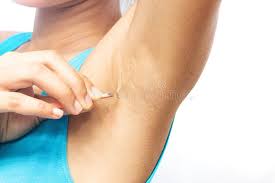 The axillary hair removal laser is one of the most often used procedures to treat unwanted hairs in that region. 1 731 Underarm Hair Removal Photos Free Royalty Free Stock Photos From Dreamstime