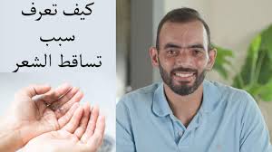 كيف تعرف نوع تساقط شعرك Youtube