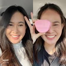 ประสบการณ์จัดฟันรอบที่ 3: ทำไมต้องจัดฟันอีกครั้ง?