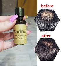 Maybe you would like to learn more about one of these? 2pcs 1set 20ml Andrea Hair Growth Essence Hair Loss Liquid