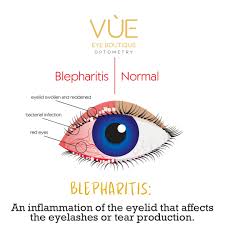 Image result for Blepharis involucrata