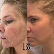 BB Aesthetic Wellness Center