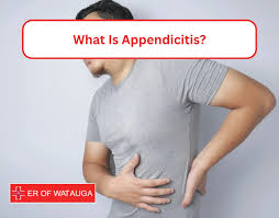 Image result for Appendicitis
