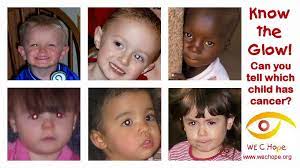 Let them know that you are available if an unexpected need. World Eyecancer Hope A Twitter Only One Of These 6 Children Has 2 Healthy Eyes Can You Tell Which One Can You Tell Which Child Has Life Threatening Eye Cancer Answer Https T Co Rnrmwrmvgr