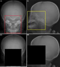 Image result for Skull XRay