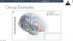 Abdullah Azeem — HBHL Research Day 2020 Flash Talk