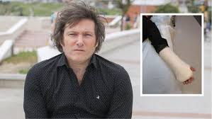 La clase denominada libertad, economía y política es particular para perú por el contexto político que vivimos, pero también es ideal si eres de otro país. A Javier Milei Lo Atacaron Sus Propios Perros Y Le Dieron Seis Puntos En El Brazo Izquierdo El Comodorense