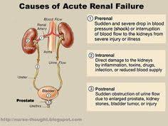 N most common identifiable causes are diabetes and vascular disease. 52 Kidney Failure Ideas Chronic Kidney Disease Kidney Failure Kidney Disease