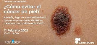El comportamiento biológico del melanoma puede presentar varias fases: Genesiscare Un Tratamiento Innovador Para Cancer De Piel No Melanoma Con Radioterapia Vmat
