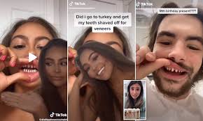 Shark Teeth Tiktok Are Not Necessary With Veneers