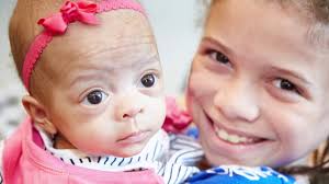 Women and Children's Health transformation