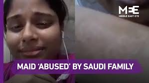 Chris redston with gillie cunningham. Bangladeshi Maid In Saudi Arabia Says Employers Poured Hot Oil On Arms Middle East Eye
