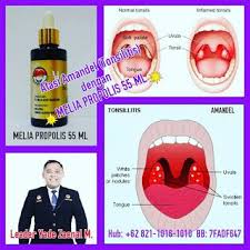 Pt Melia Sehat Sejahtera Manfaat Propolis Untuk Radang Tenggorokan Pengawetan Penyakit