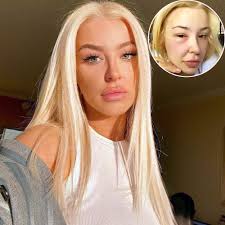 View his overall, offense & defense attributes, badges, and compare him with other players in the league. Tana Mongeau Posts Throwback Pics While Suffering From A Swollen Eye