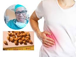 Hamid arshat juga menyarankan supaya berat badan anda tidak melebihi 60kg. Dr Hamid Arshat Kongsi Petua Natural Atasi Batu Karang Hempedu Tanpa Bedah Guna 4 Bahan Maskulin
