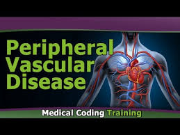 Peripheral Vascular Disease Icd 9 Coding For Beginners