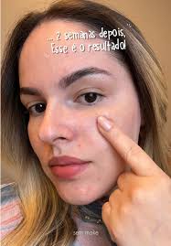 Transformação da Pele com Power Duo Eucerin