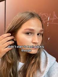 Eyebrow Tint Allergy Remedy