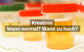 Kreatinin Bedeutung Werte Normal Niedrig Hoch