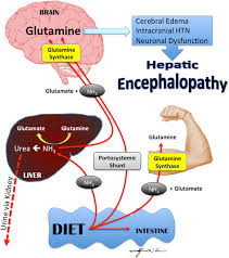 Are the organs related to the digestive system. Figure 1 Retrograde Transvenous Obliteration Rto A New Treatment Option For Hepatic Encephalopathy Springerlink