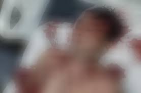 Segundo o secretário de saúde do município, rui borges, foram contadas 38 marcas de tiro no corpo de lázaro.reproduções de vídeos. Koidylxotloehm