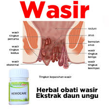 Jenis penyakit wasir ambeien apa obat untuk penderita penyakit wasir _ penyakit ambeien adalah suatu penyakit yang. Cod Teh Celup Daun Ungu Untuk Wasir Ambeien Sale Lazada Indonesia