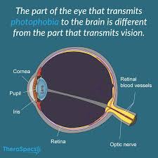 Photophobia Pathway Eye To Brain Light Sensitivity Health Info Eye Health